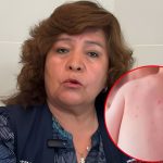 Intensifican vacunación contra el sarampión tras caso confirmado en Ilo